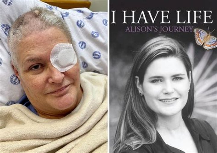 Alison Botha Biography; Injuries, Husband, Documentary, Pictures