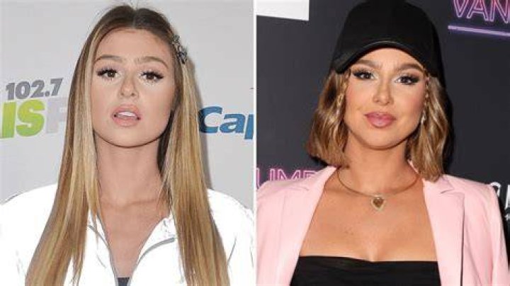 Ariana Madix’s Plastic Surgery: The Vanderpump Rules Star Claims to be a Natural Beauty Who Had Just Had Botox, Lip Fillers, and Jawline Surgery!