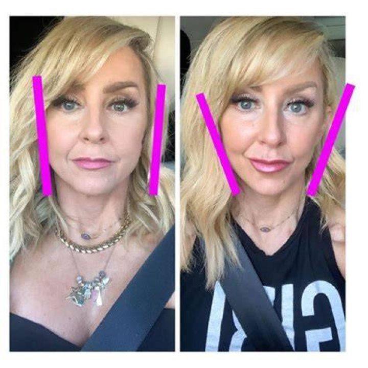 Chalene Johnson Plastic Surgery Photos – Before and After, How Does She Look Now?