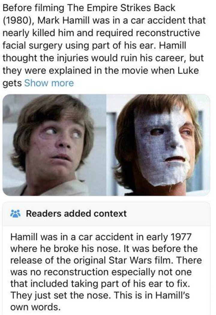 Crash: Mark Hamill Car Accident Injury Fractured Nose And Left Cheekbone