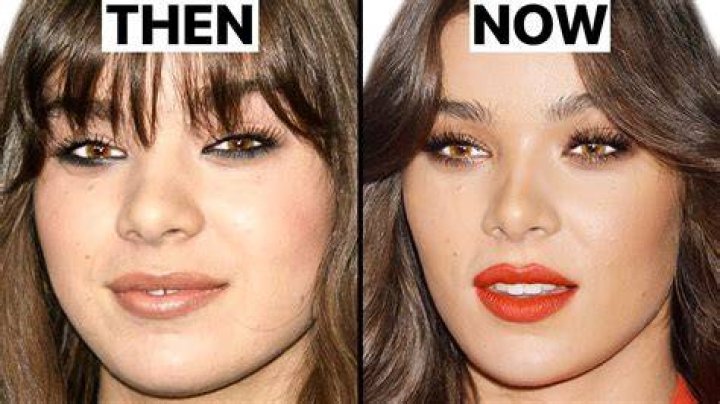 Did Hailee Steinfeld Undergo Nose Job? Plastic Surgery Rumors Addressed