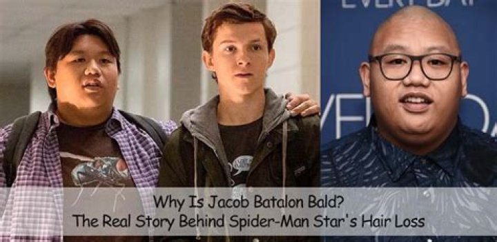 Does Jacob Batalon Wear A Wig? Details About His Hair Loss And Why He Is Bald