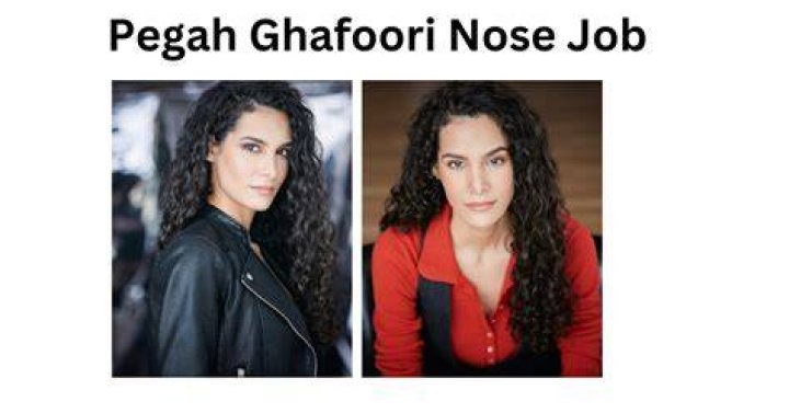 Has Pegah Ghafoori Received a Nose Job? Detail on Her Plastic Surgery!