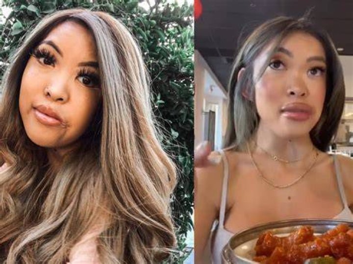 Jennifer Ngo Tiktok Disability: Whats Wrong With Jennifer Ngos Face