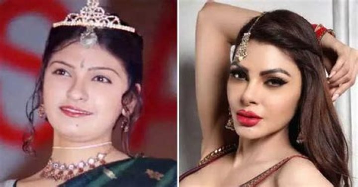 Sherlyn Chopra’s Plastic Surgery: Every Procedures She Has Received!