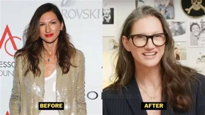 What Happened To Jenna Lyons Teeth? Before And After Photo
