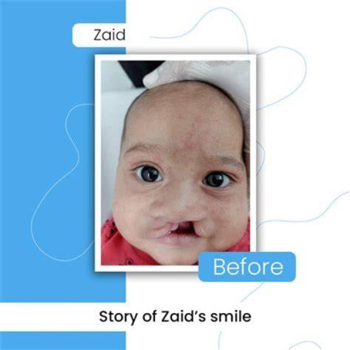 Zaid Garcia Before And After: Photos Of His As A Baby